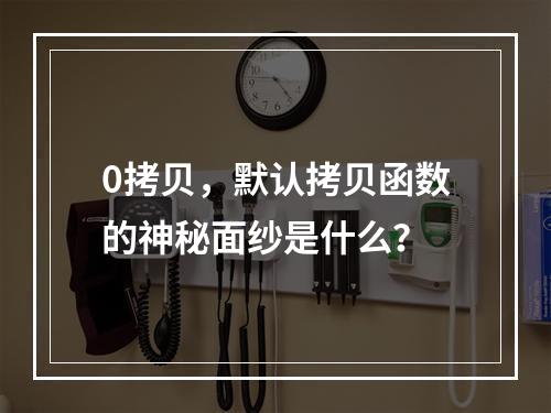 0拷贝,默认拷贝函数的神秘面纱是什么?